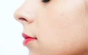 產後特發性顏面神經麻痺 中醫助復原