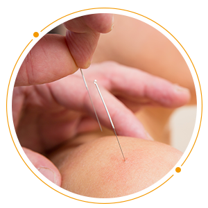 indications-acupuncture