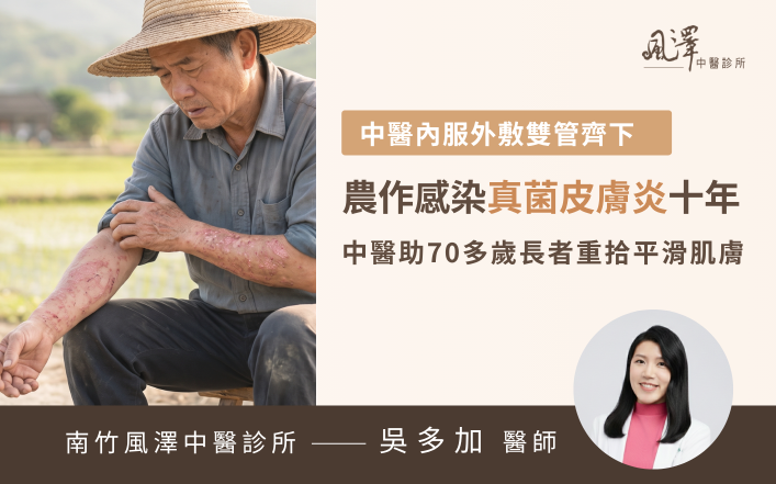 70歲長者因務農感染真菌皮膚炎，手臂出現反覆發作的紅腫脫屑斑塊與嚴重搔癢症狀。