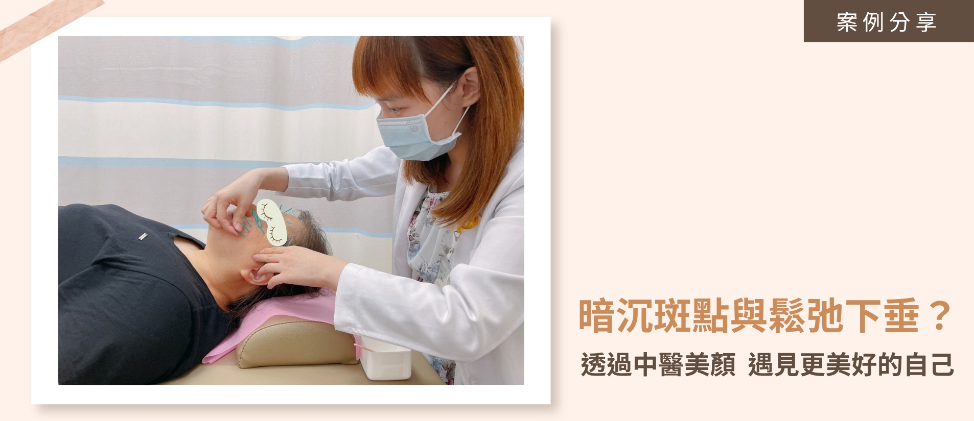王毓婷院長為患者施作美顏針